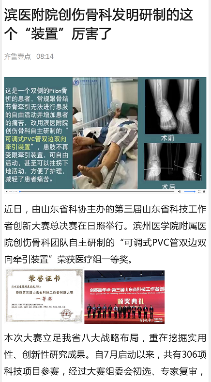 齐鲁壹点 2019.12.12 滨医附院创伤骨科发明研制的这个“装置”厉害了.png